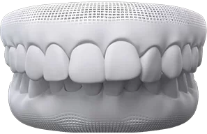 invisalign for overbite